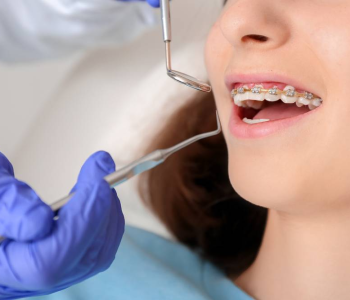 5 Things to Know Before Starting Orthodontic Treatment